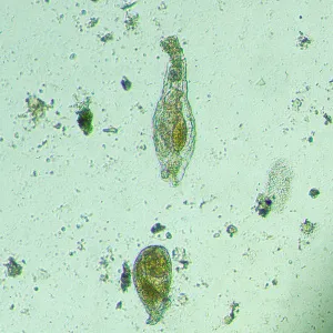 Микроскоп биологический инвертированный цифровой MAGUS Bio VD300, изображение 18